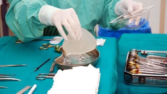 krūtų didinimo implantas